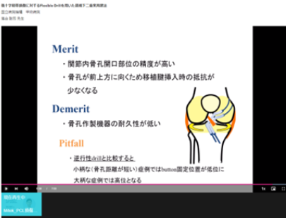 鏡視下靭帯再建術の動画