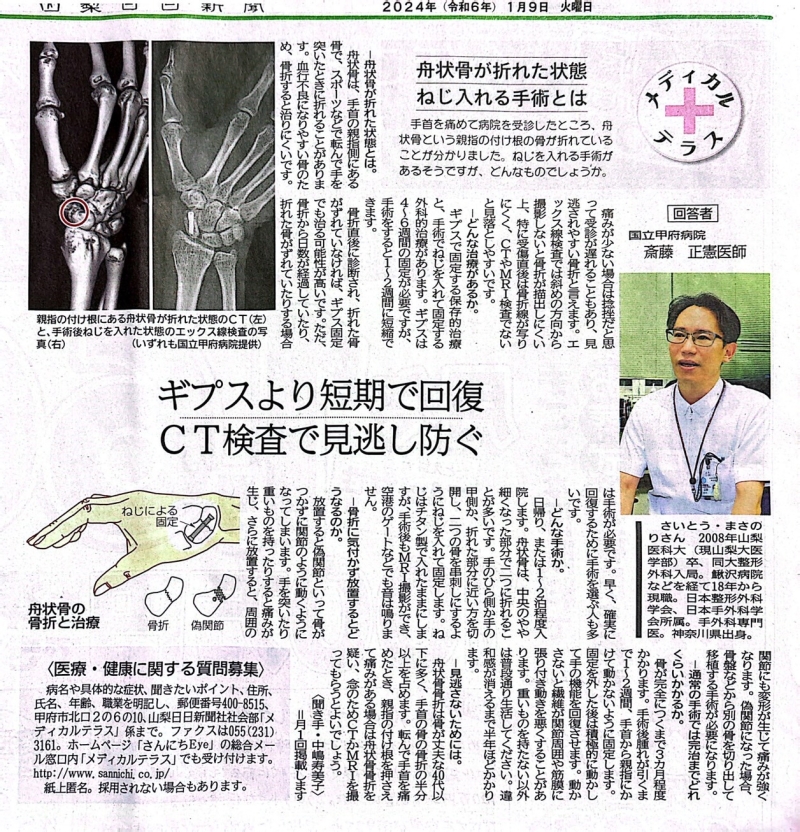 手舟状骨骨折に関する記事